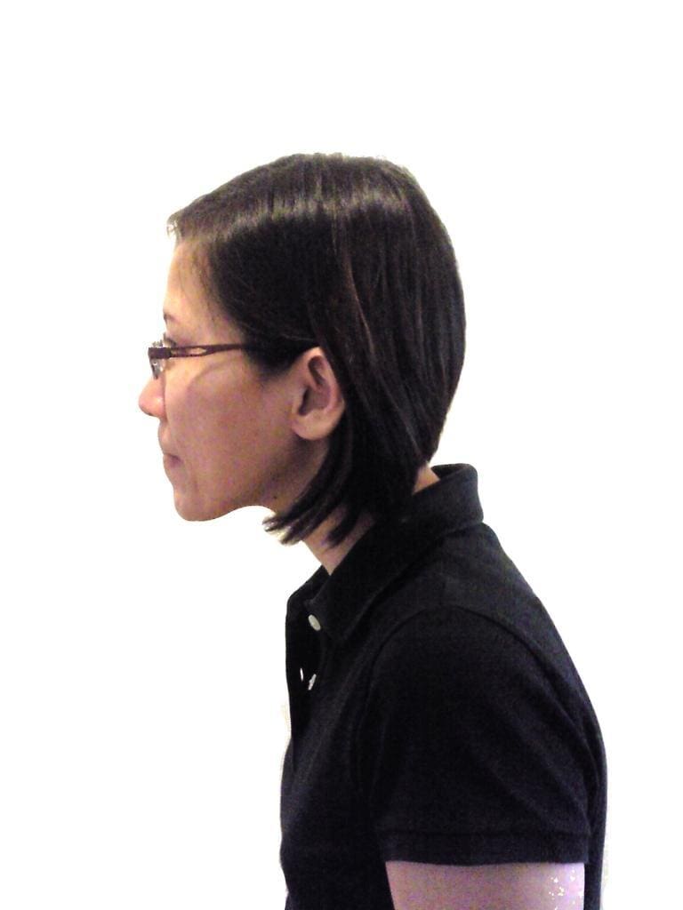 Figure 1: Forward Head Posture